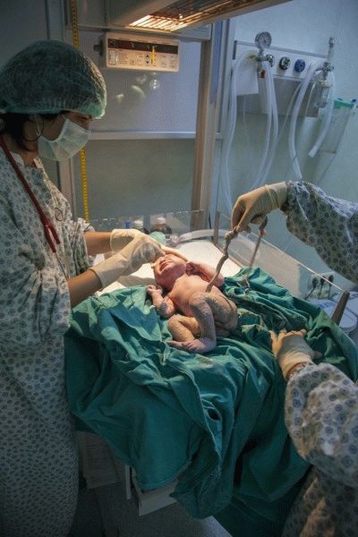 Вторая в мире женщина смогла стать матерью после операции по пересадке матки<br>